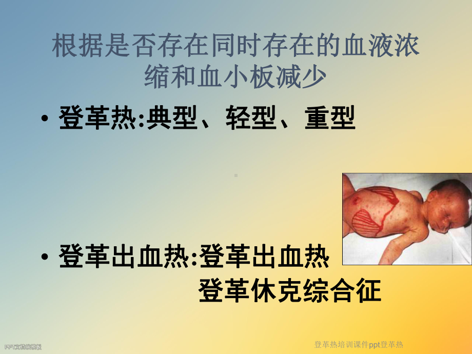 登革热培训课件登革热.ppt_第3页