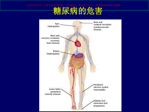 糖尿病微血管并发症DKD肾病培训课件.ppt