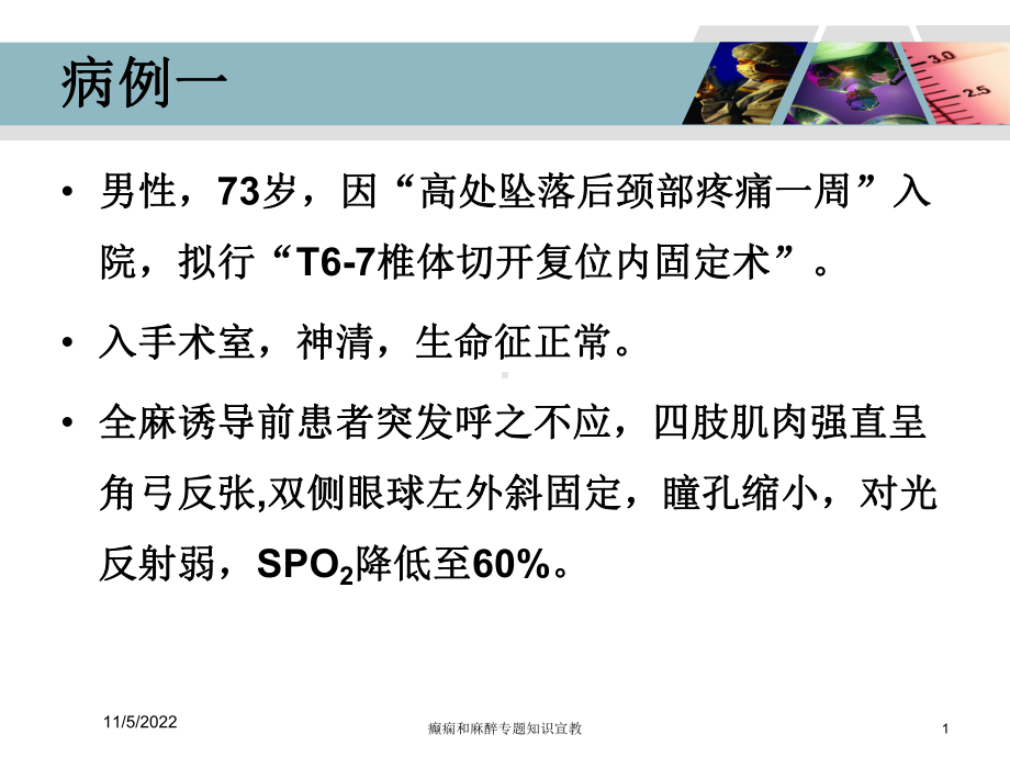 癫痫和麻醉专题知识宣教培训课件.ppt_第1页