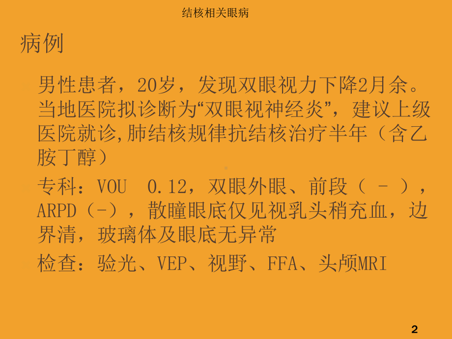 结核相关眼病培训课件.ppt_第2页