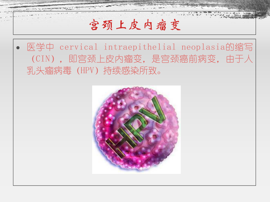 CIN癌变现象要点讲解课件.ppt_第2页