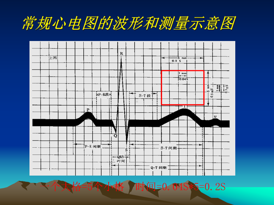 第二节-心电图的测量和正常数据课件.ppt_第3页