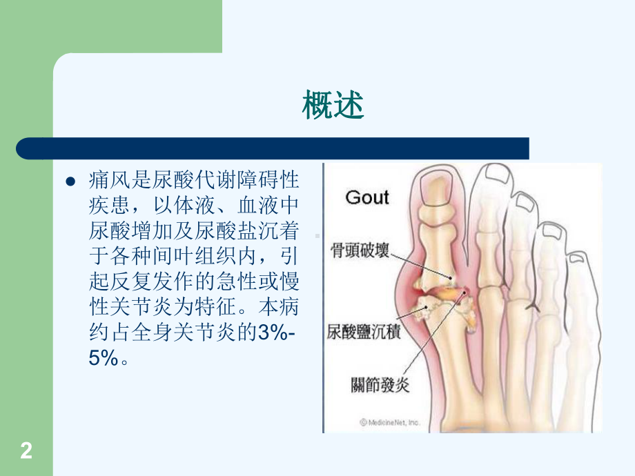 痛风结节的影像表现课件.ppt_第2页