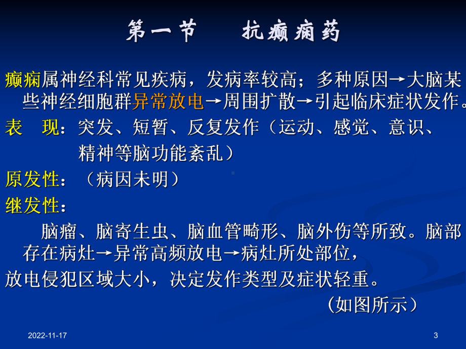 癫痫的学习任务课件.ppt_第3页