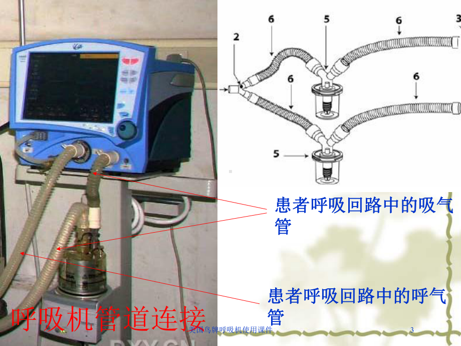 美国鸟牌呼吸机使用课件培训课件.ppt_第3页