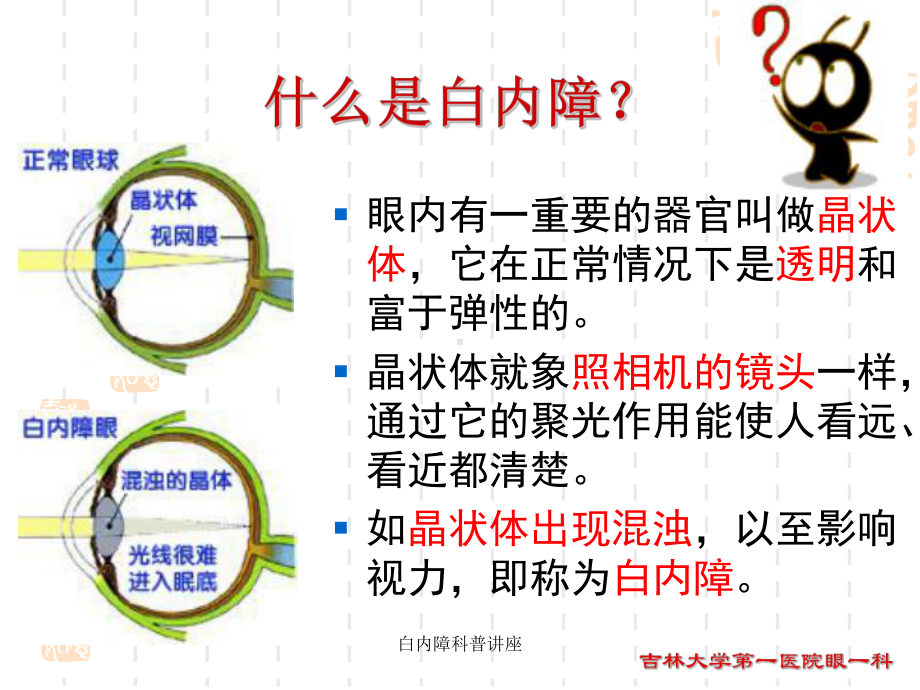 白内障科普讲座培训课件.ppt_第3页