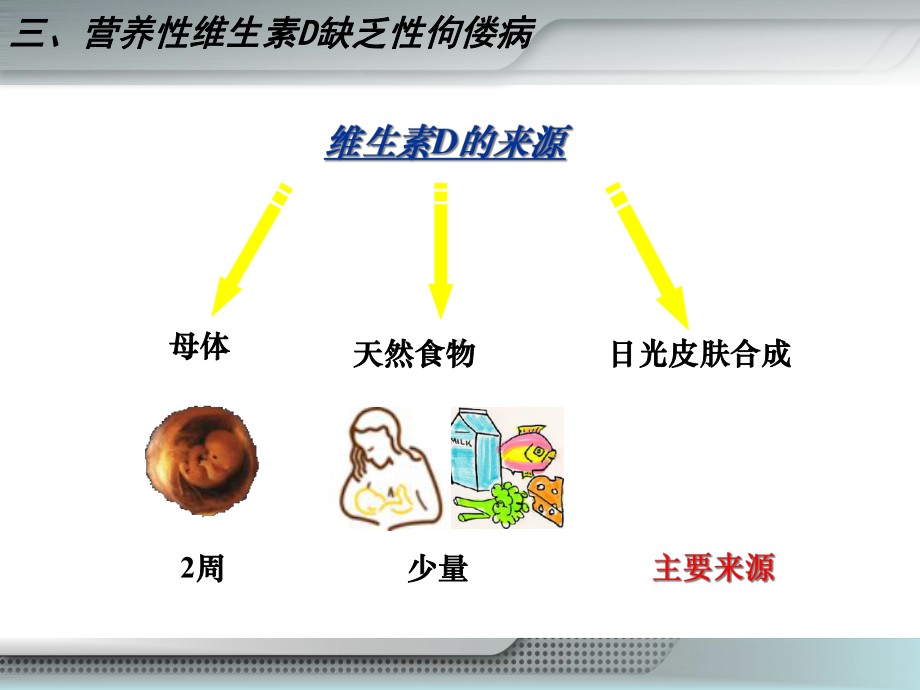 七章佝偻病患儿的护理课件.ppt_第3页