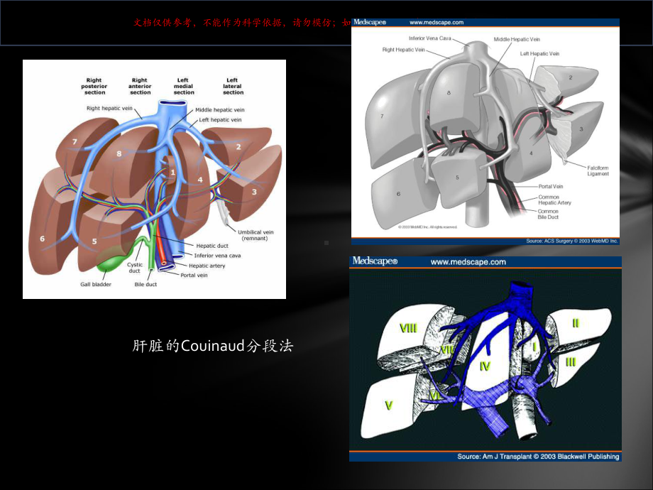 肝脏外科新概念和技术进展培训课件.ppt_第3页