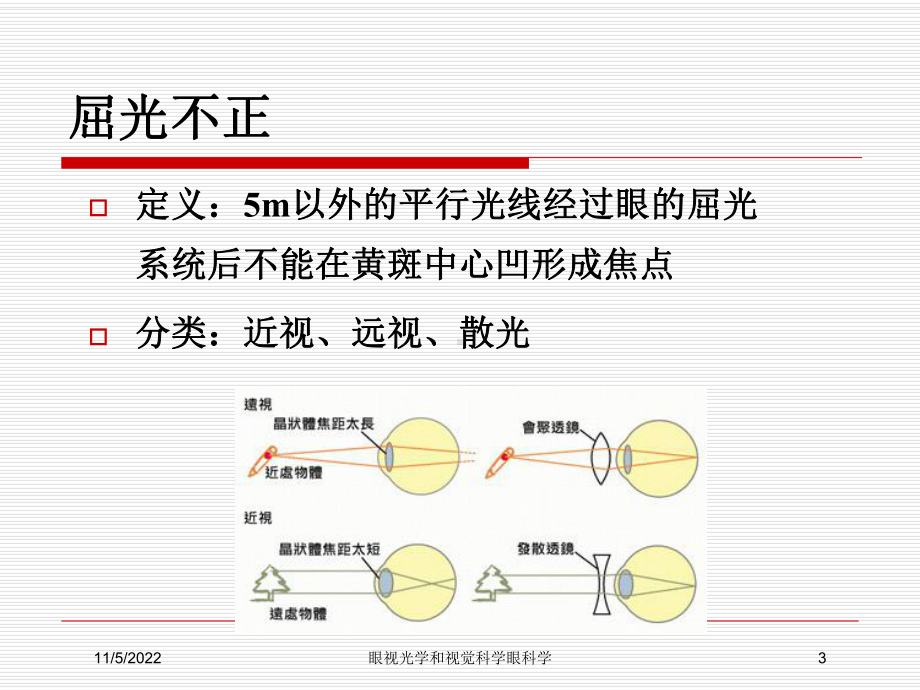 眼视光学和视觉科学眼科学培训课件.ppt_第3页