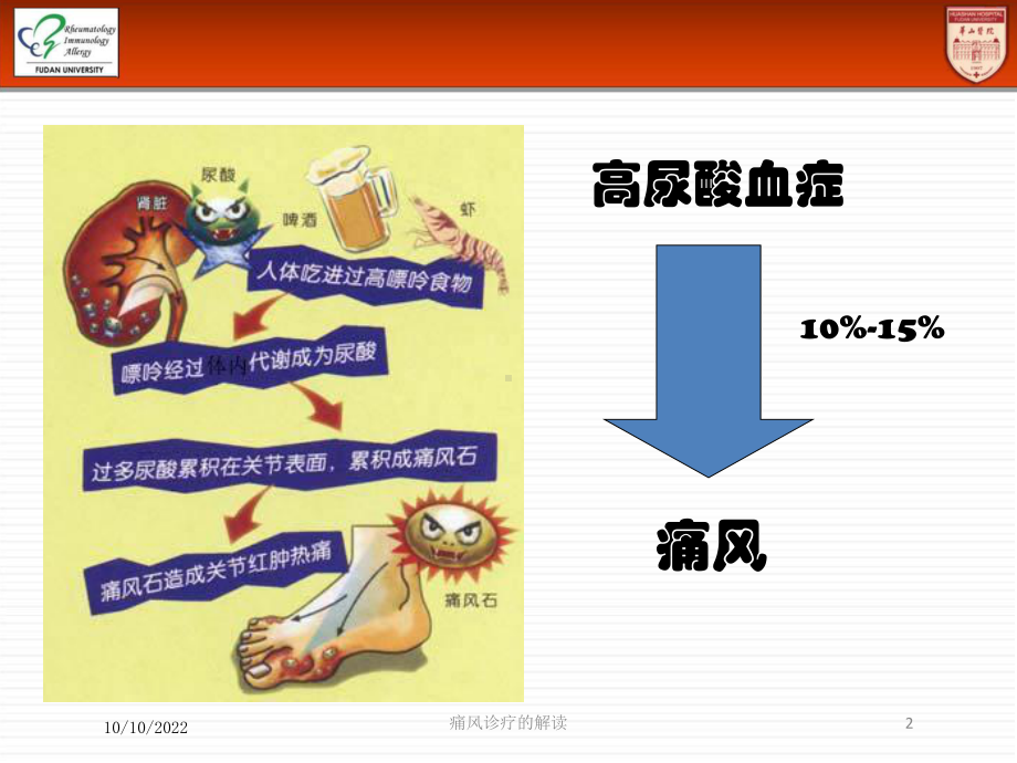 痛风诊疗的解读培训课件.ppt_第2页