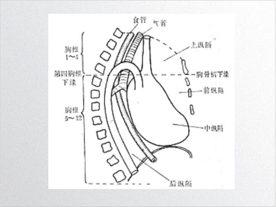 纵隔肿瘤影像诊断[2]1课件.ppt_第3页