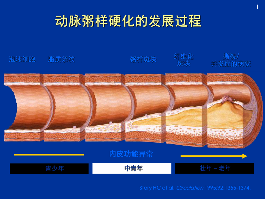 B阻滞剂与冠心病治疗课件1.ppt_第3页