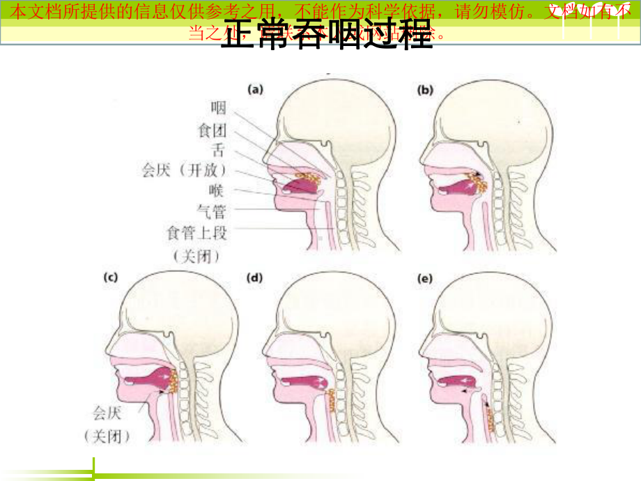 老年人吞咽障碍的评估和护理培训课件.ppt_第3页