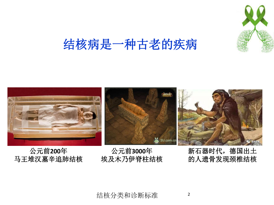 结核分类和诊断标准培训课件.ppt_第2页