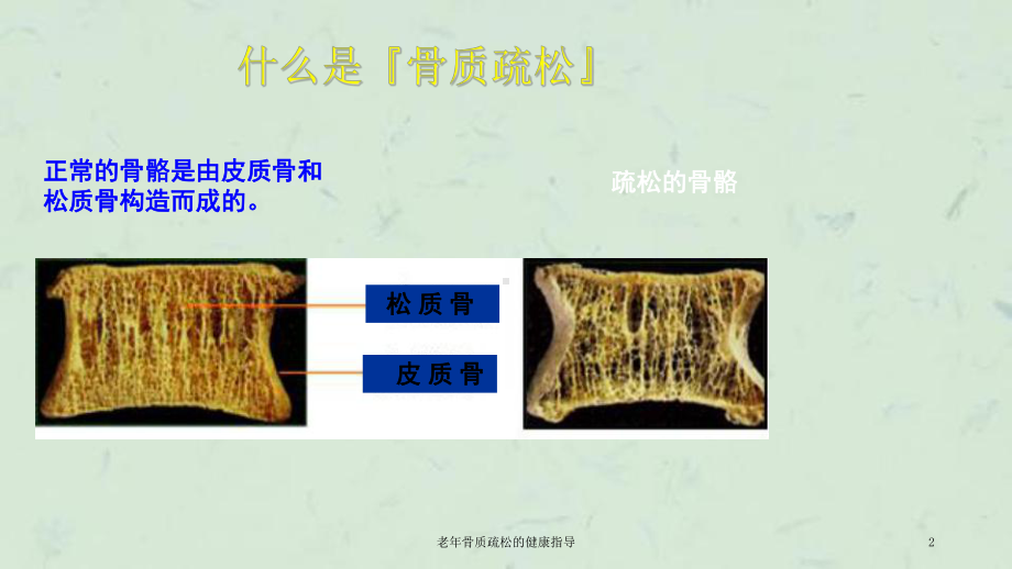 老年骨质疏松的健康指导课件.ppt_第2页