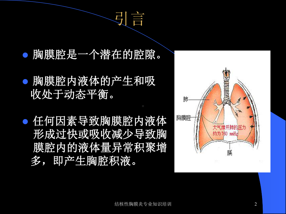 结核性胸膜炎专业知识培训培训课件.ppt_第2页