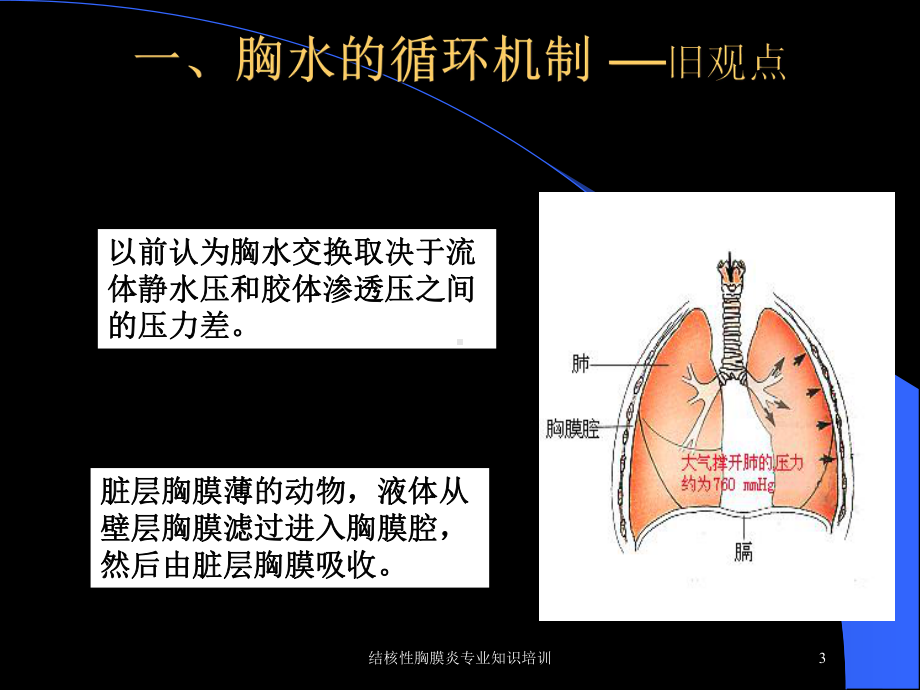 结核性胸膜炎专业知识培训培训课件.ppt_第3页