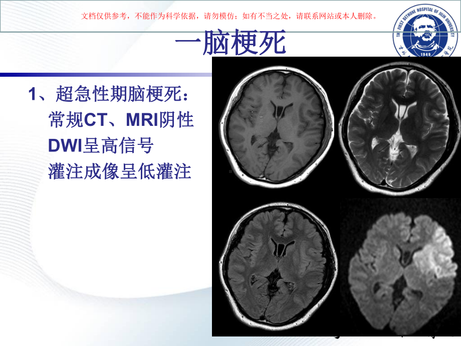 神经脑血管病影像培训课件.ppt_第3页