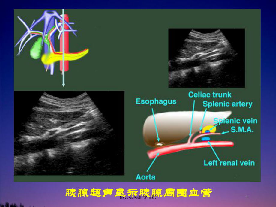 磁共振胰胆管造影培训课件.ppt_第3页