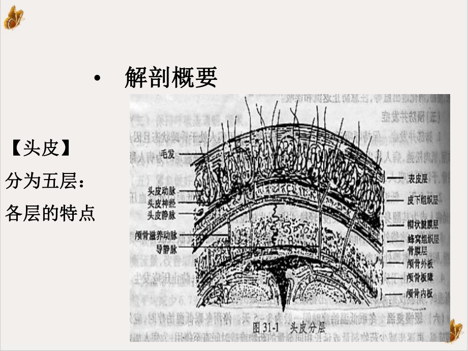 二节颅脑损伤病人的护理课件.ppt_第3页