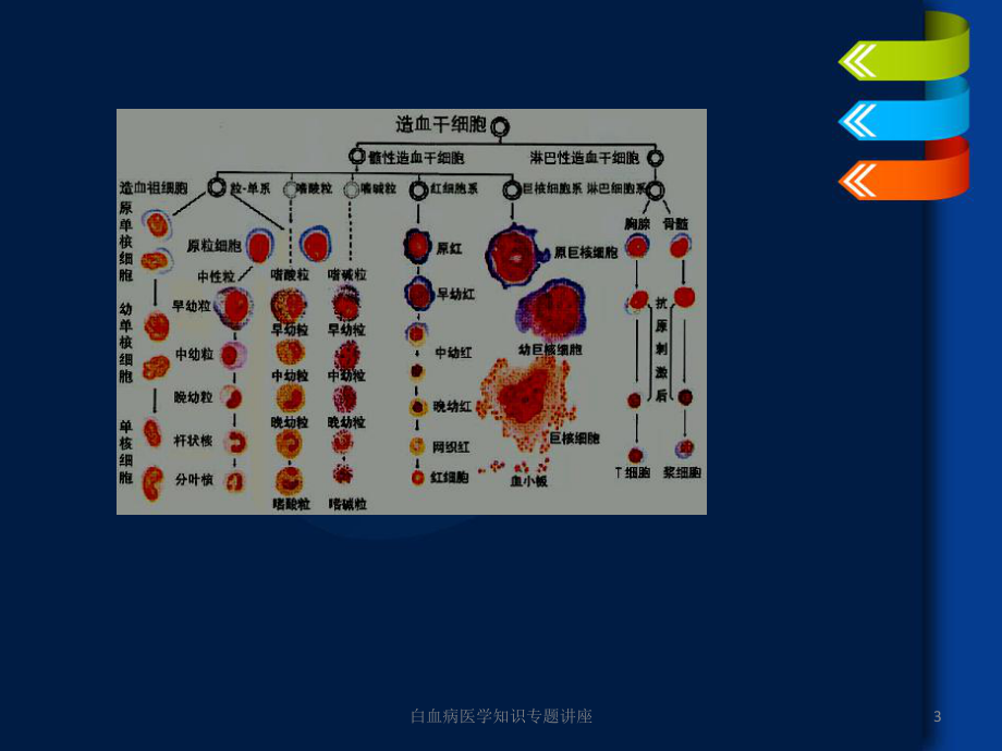 白血病医学知识专题讲座培训课件.ppt_第3页