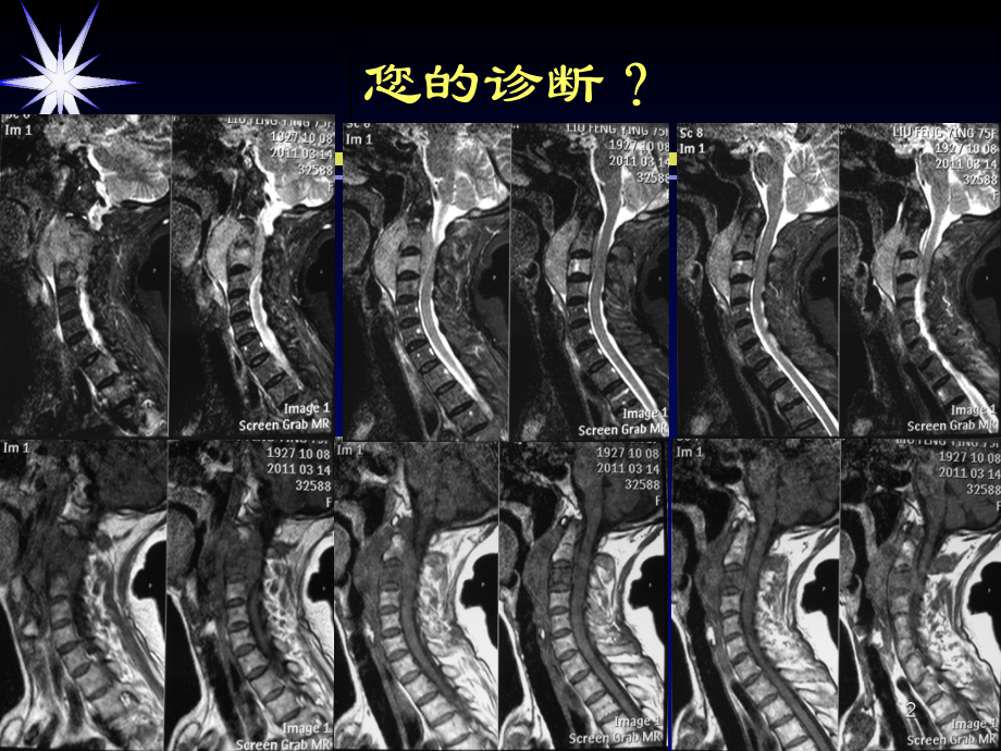 磁共振类PET临床应用教学课件.ppt_第2页