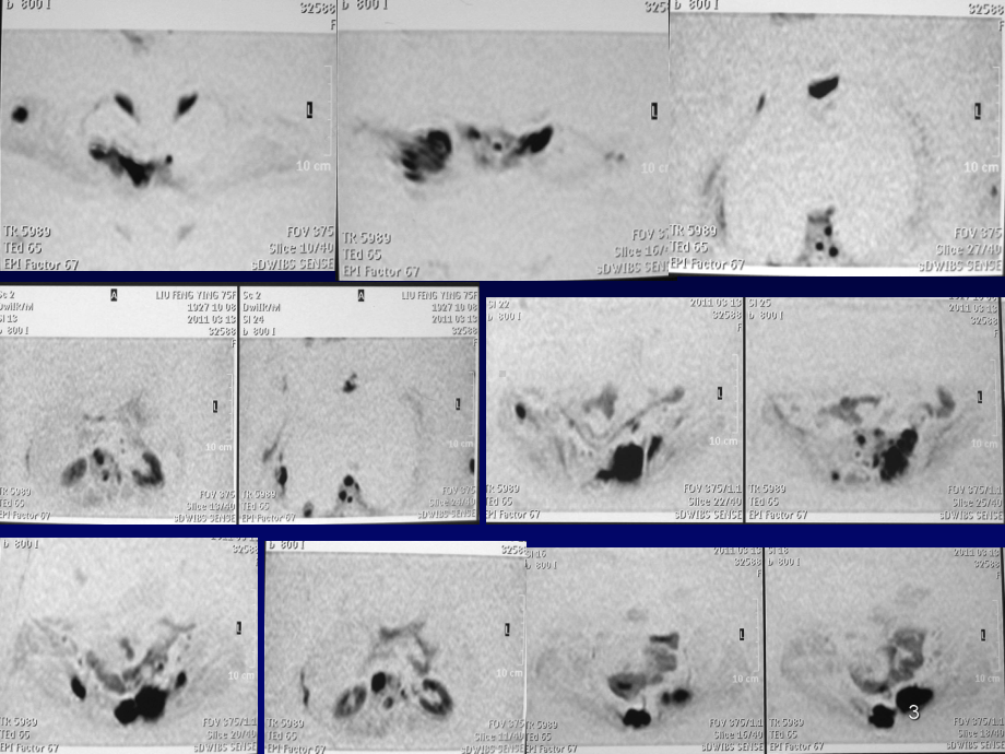 磁共振类PET临床应用教学课件.ppt_第3页