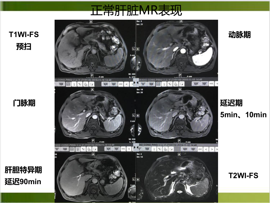 肝脏的表现讲课课件.ppt_第2页