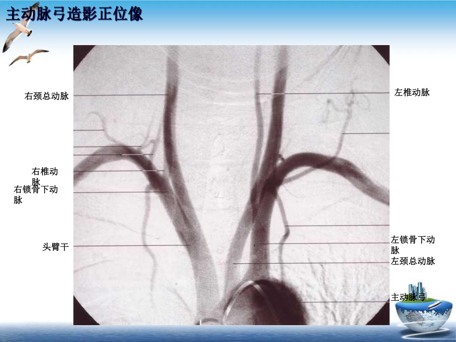 神经血管解剖图培训讲义课件.ppt_第2页