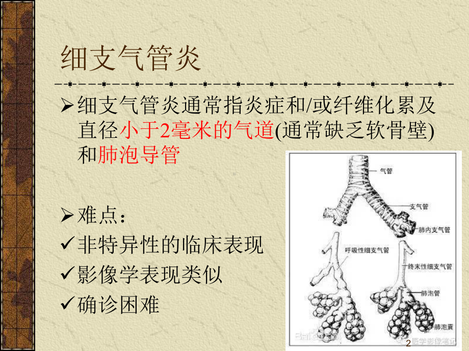 细支气管炎课件-2.ppt_第2页