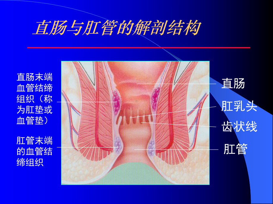 痔的套扎治疗课件.pptx_第2页