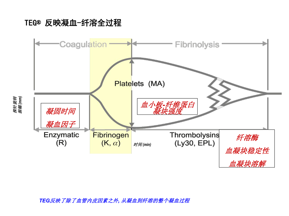 TEG血栓弹力图在骨科围术期的应用课件.ppt_第3页