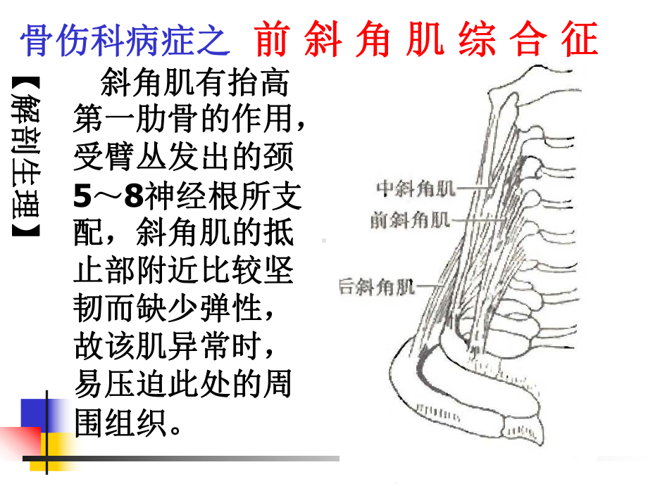 503前斜角肌综合征解析课件.ppt_第3页