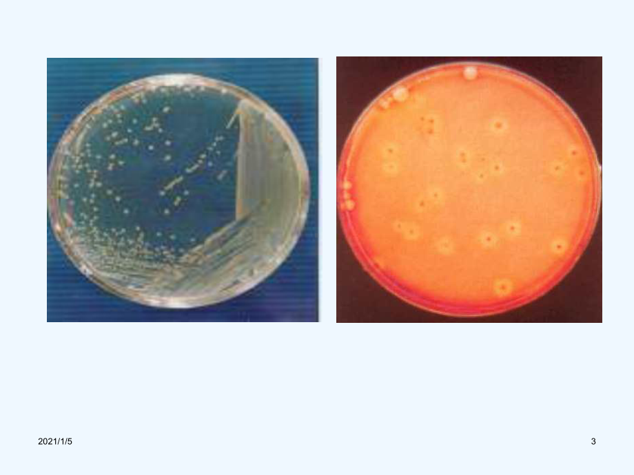 细菌各论简单-基础医学概论课件.ppt_第3页