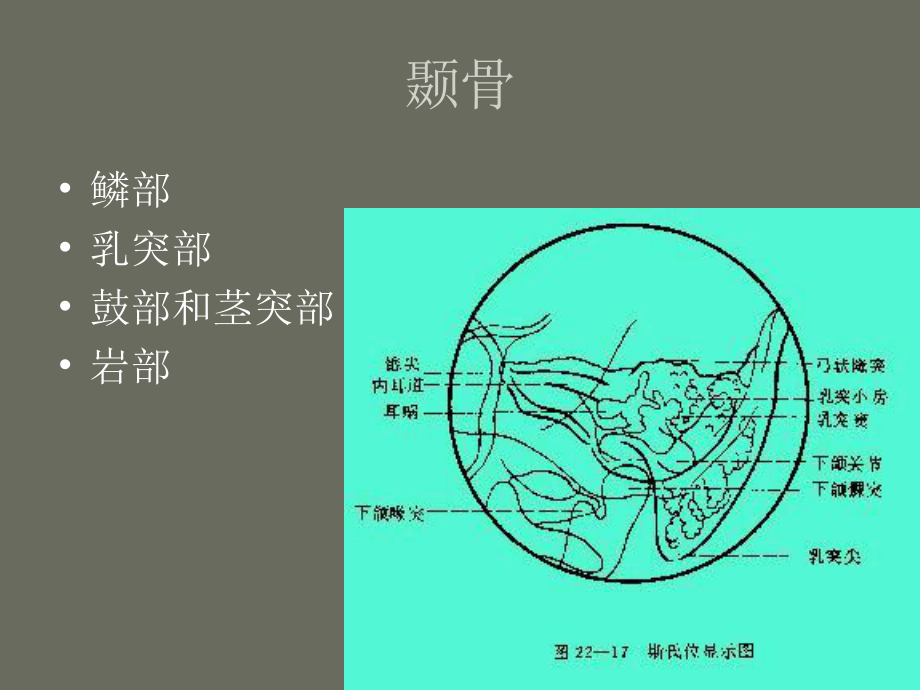 耳内疾病影像诊断课件.pptx_第2页