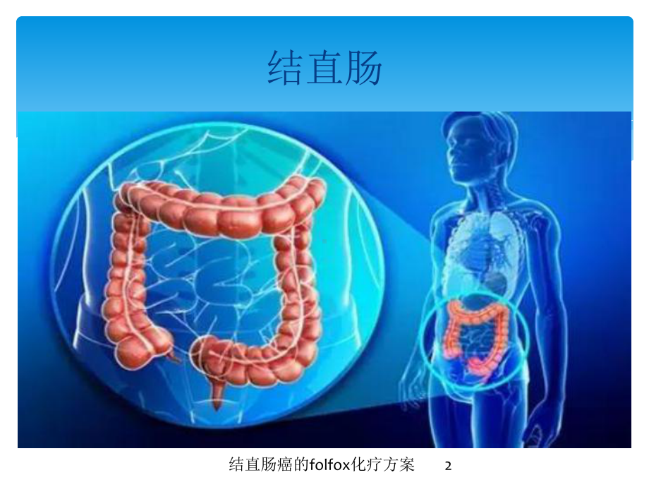 结直肠癌的folfox化疗方案培训课件.ppt_第2页