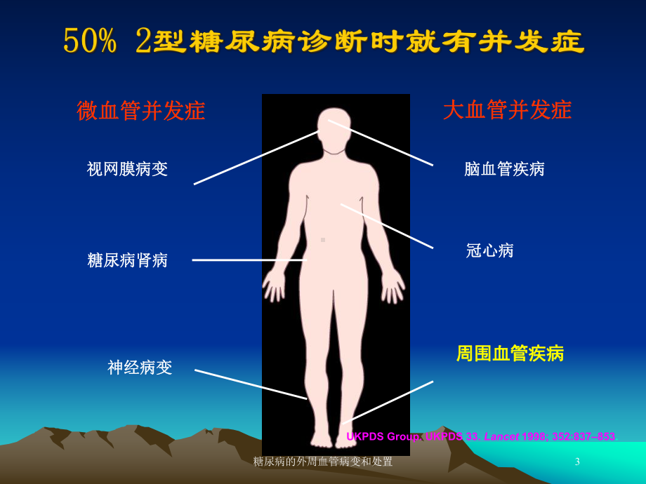 糖尿病的外周血管病变和处置培训课件.ppt_第3页