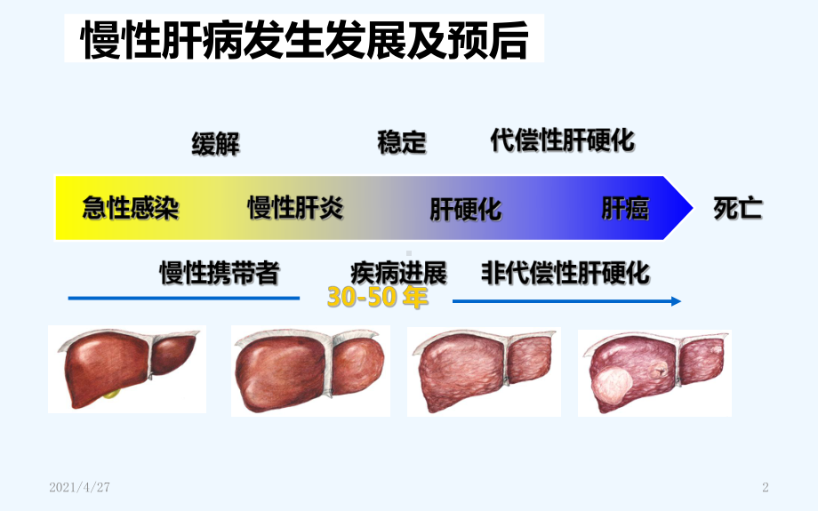 肝硬化治疗利器TIPS手术课件2.ppt_第2页