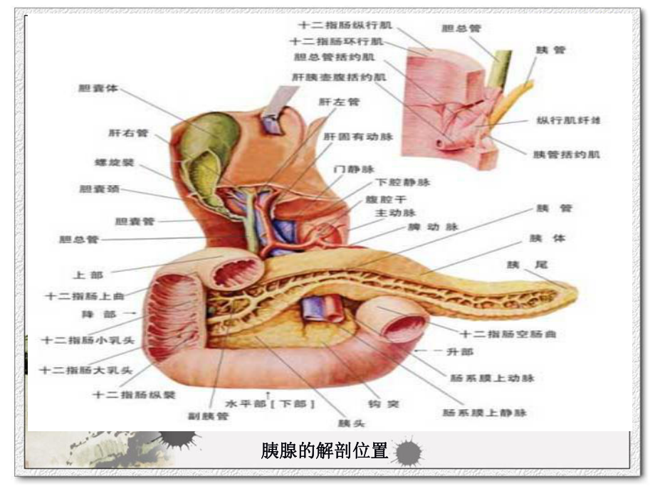 第七节急性胰腺炎病人的护理课件.ppt_第3页