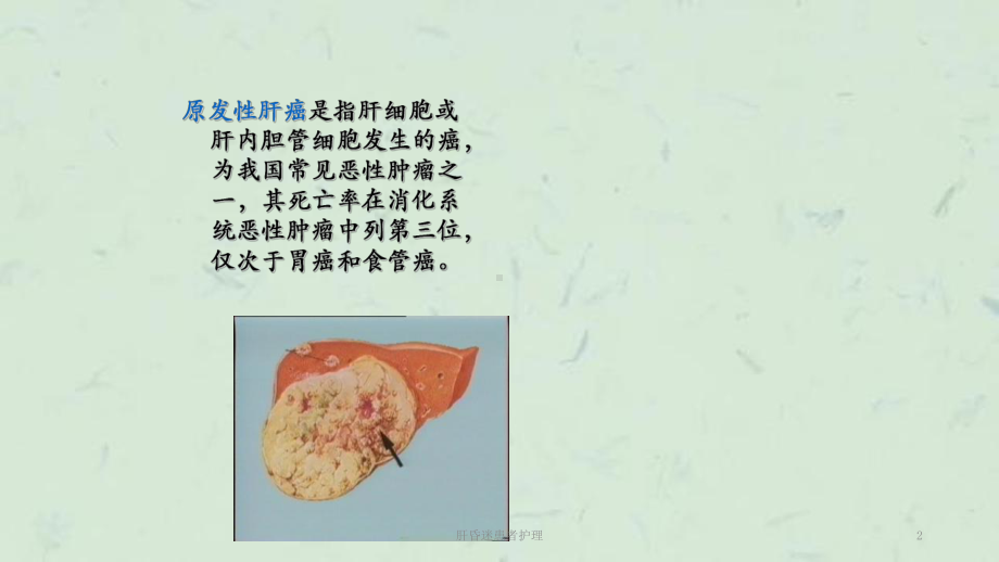 肝昏迷患者护理课件.ppt_第2页