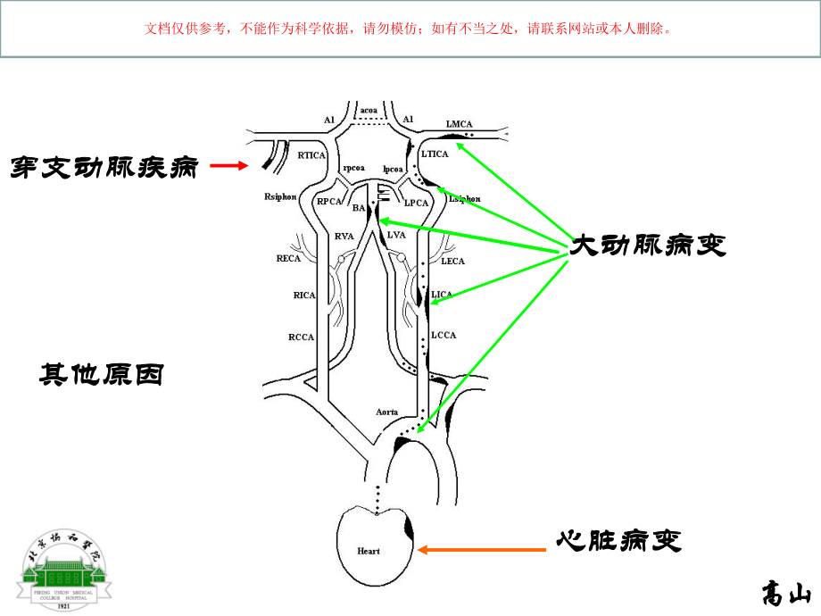 缺血性卒中的病理生理机制课件.ppt_第1页