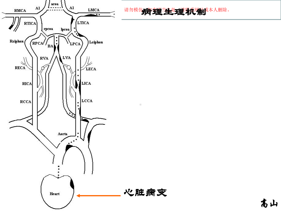 缺血性卒中的病理生理机制课件.ppt_第2页