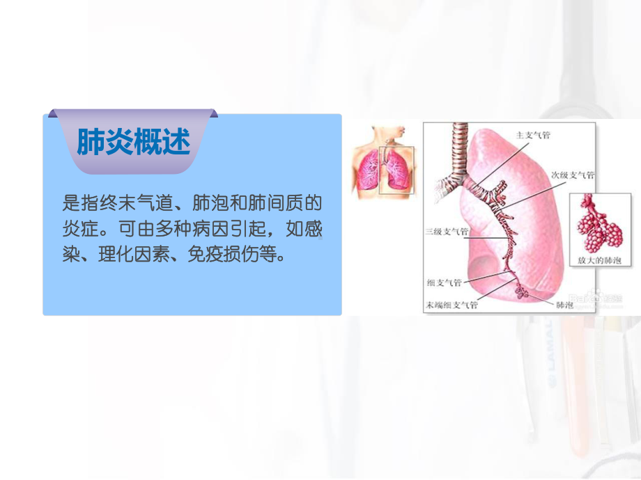 社区获得性肺炎的护理课件.pptx_第2页