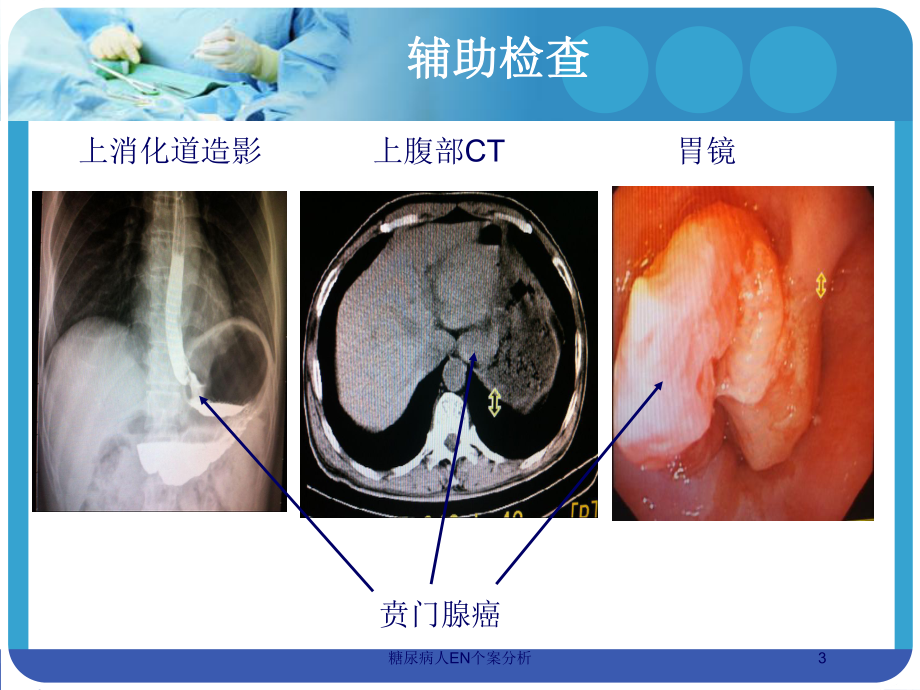 糖尿病人EN个案分析培训课件.ppt_第3页