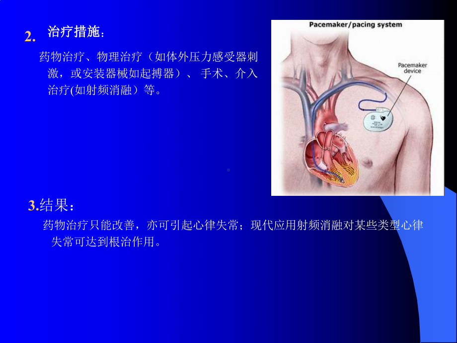 第22章抗心律失常药名师编辑课件.ppt_第3页