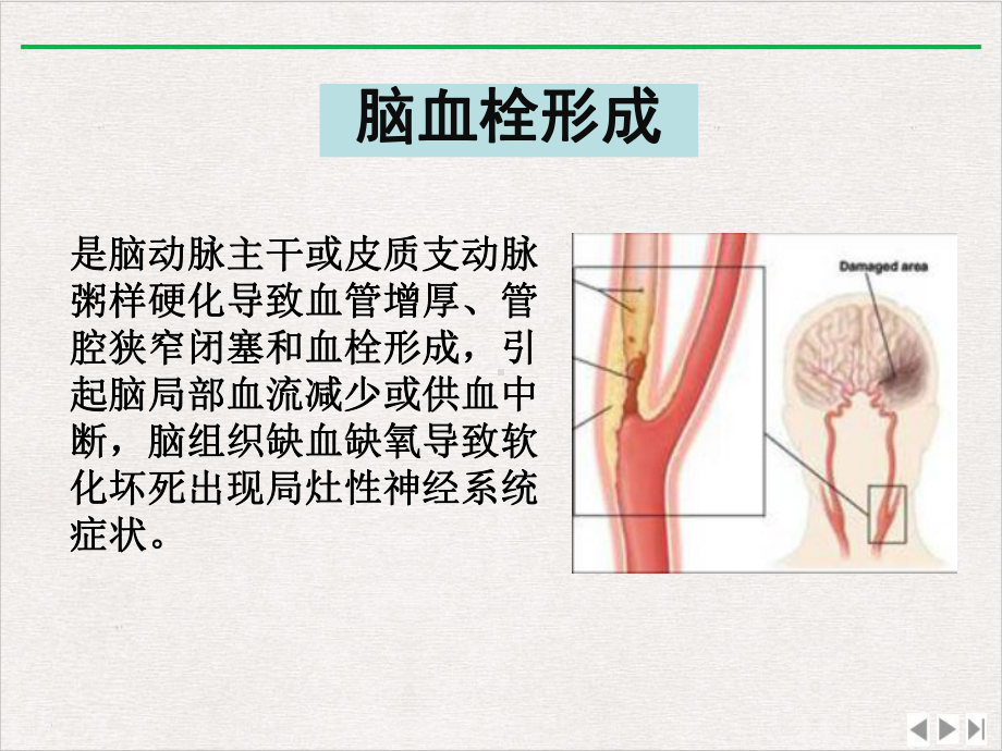 神经病学脑血管病版课件.pptx_第1页