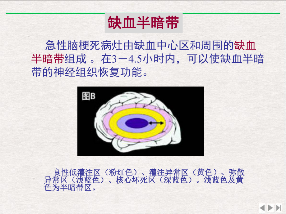 神经病学脑血管病版课件.pptx_第3页