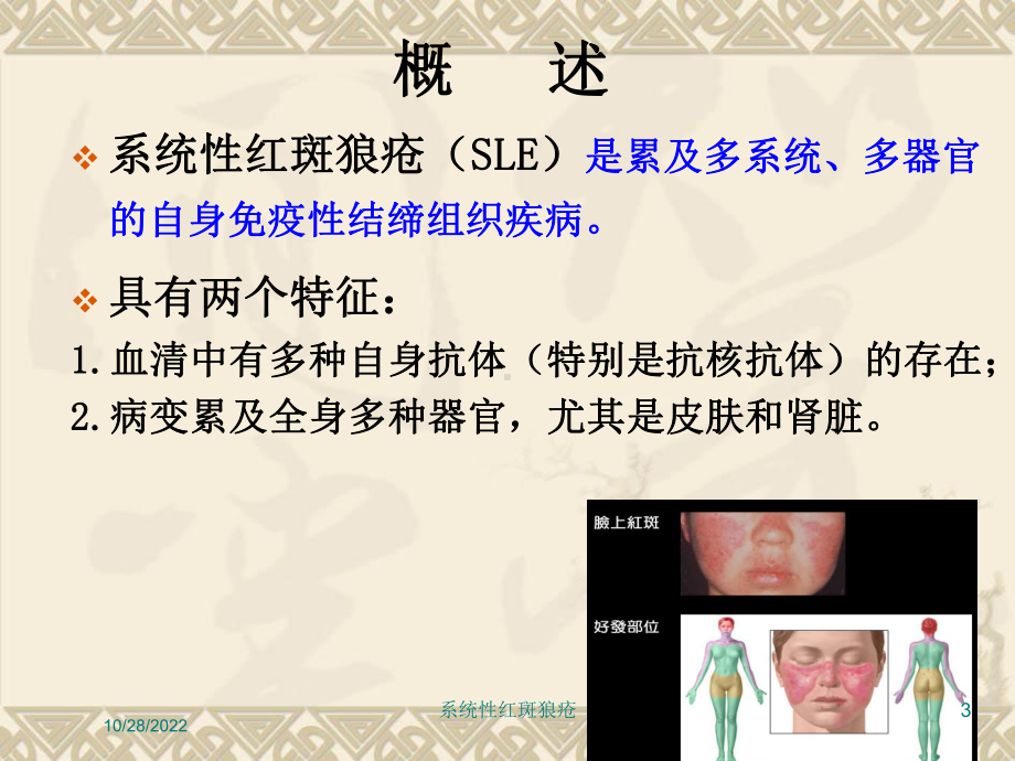 系统性红斑狼疮-培训课件.ppt_第3页