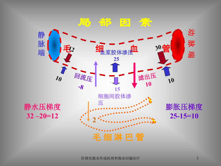 肝硬化腹水形成机理和腹水回输治疗培训课件.ppt_第3页