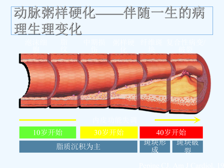 稳定性冠心病不等于斑块稳定课件.ppt_第2页